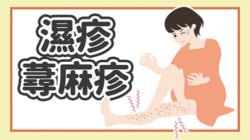 濕疹蕁麻疹 濕疹蕁麻疹